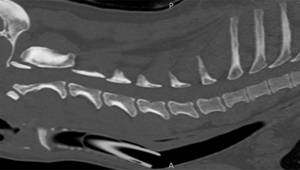 scan cervical